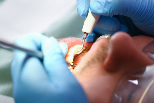 Best Emergency Dentist for Lost Fillings or Crowns in Hackleburg, AL