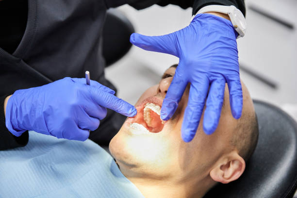 Best Emergency Dentist for Lost Fillings or Crowns in Hackleburg, AL